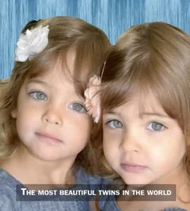 The Most Beautiful Twins In The World