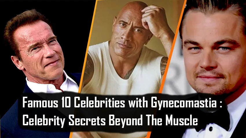 Celebrities with Gynecomastia