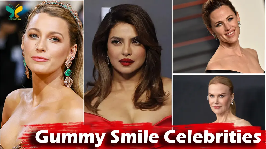 Gummy Smile Celebrities